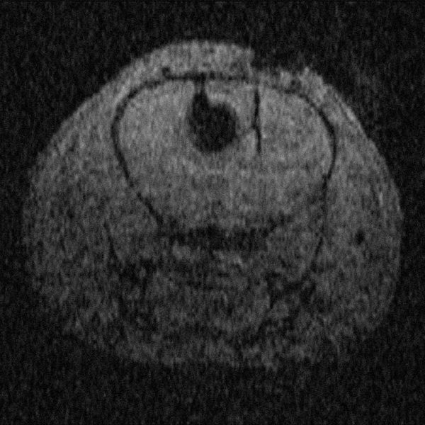 FeraTrack Direct MRI контрастирующий агент