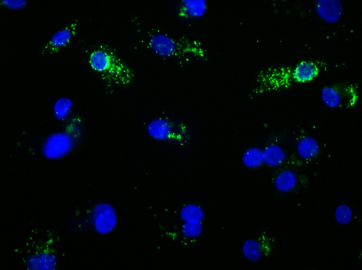 ncoming-HIV-1-RNA-green-visualised-within-macrophages-blue-nuclei-4-hours-after-infection-using-RNA-FISH